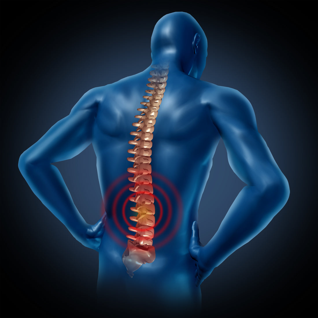 How to Naturally Prevent and Reduce Back Pain